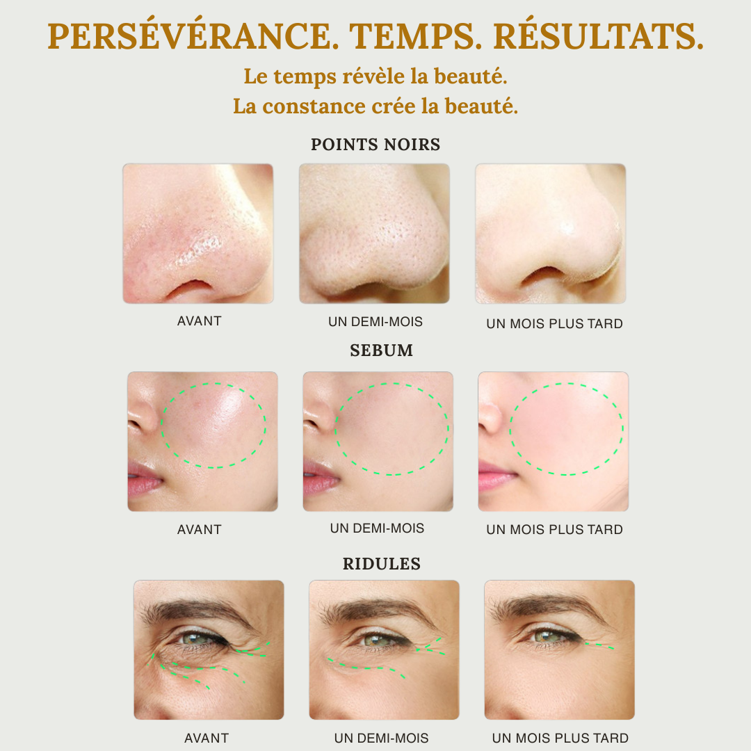 Epurateur facial à ultrasons