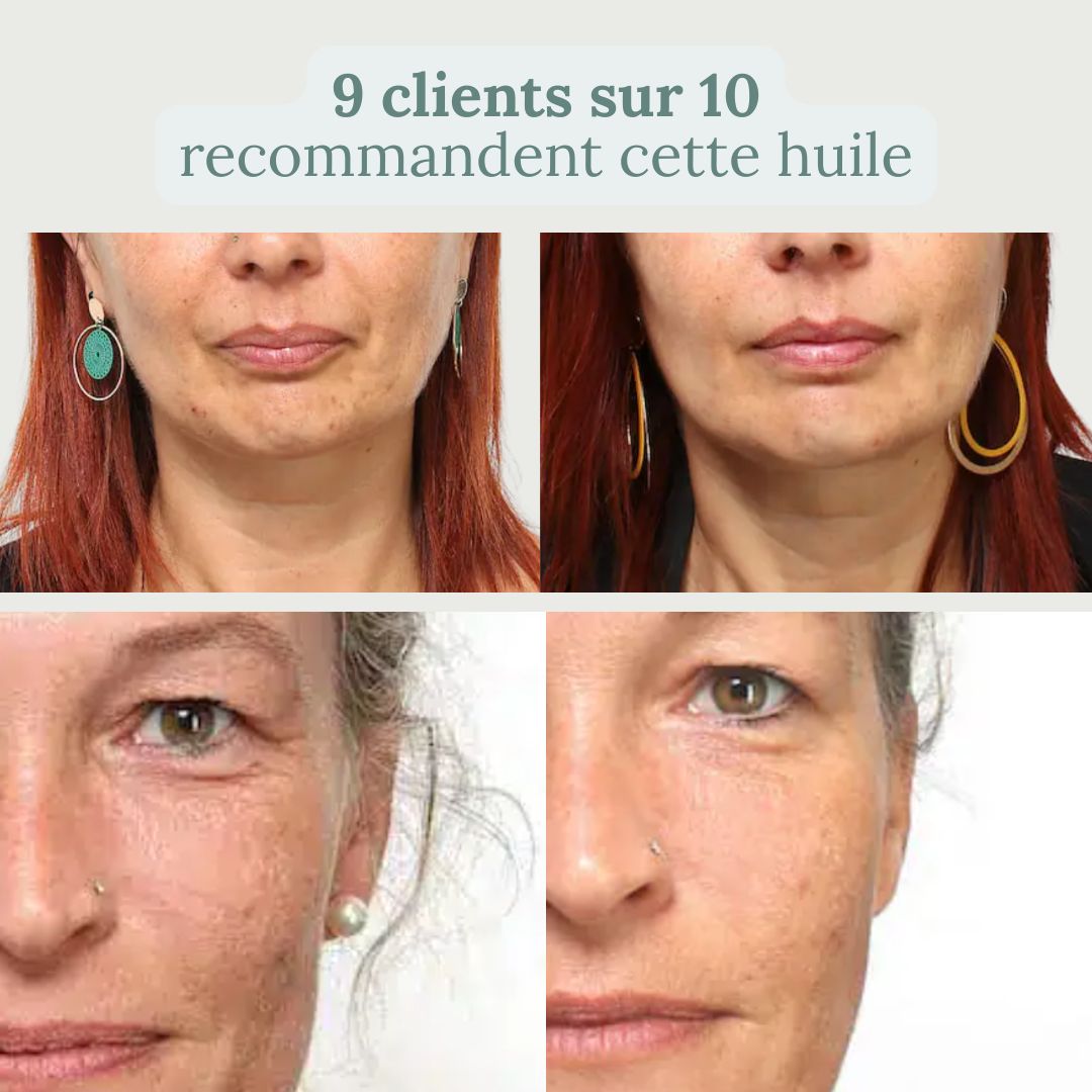 Huile anti-âge bakuchiol 3%