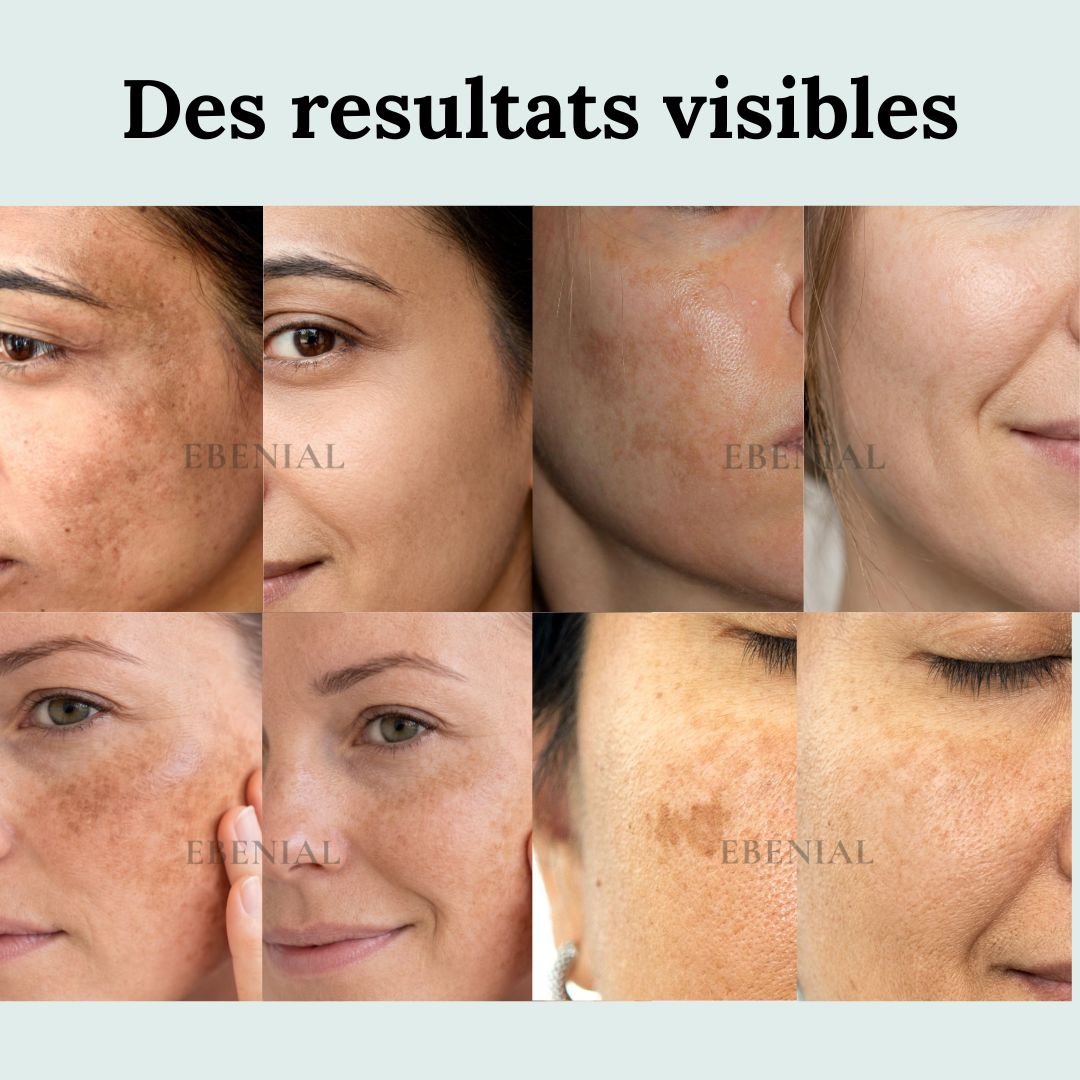 Pack soin après été